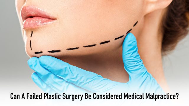 Can A Failed Plastic Surgery Be Considered Medical Malpractice?