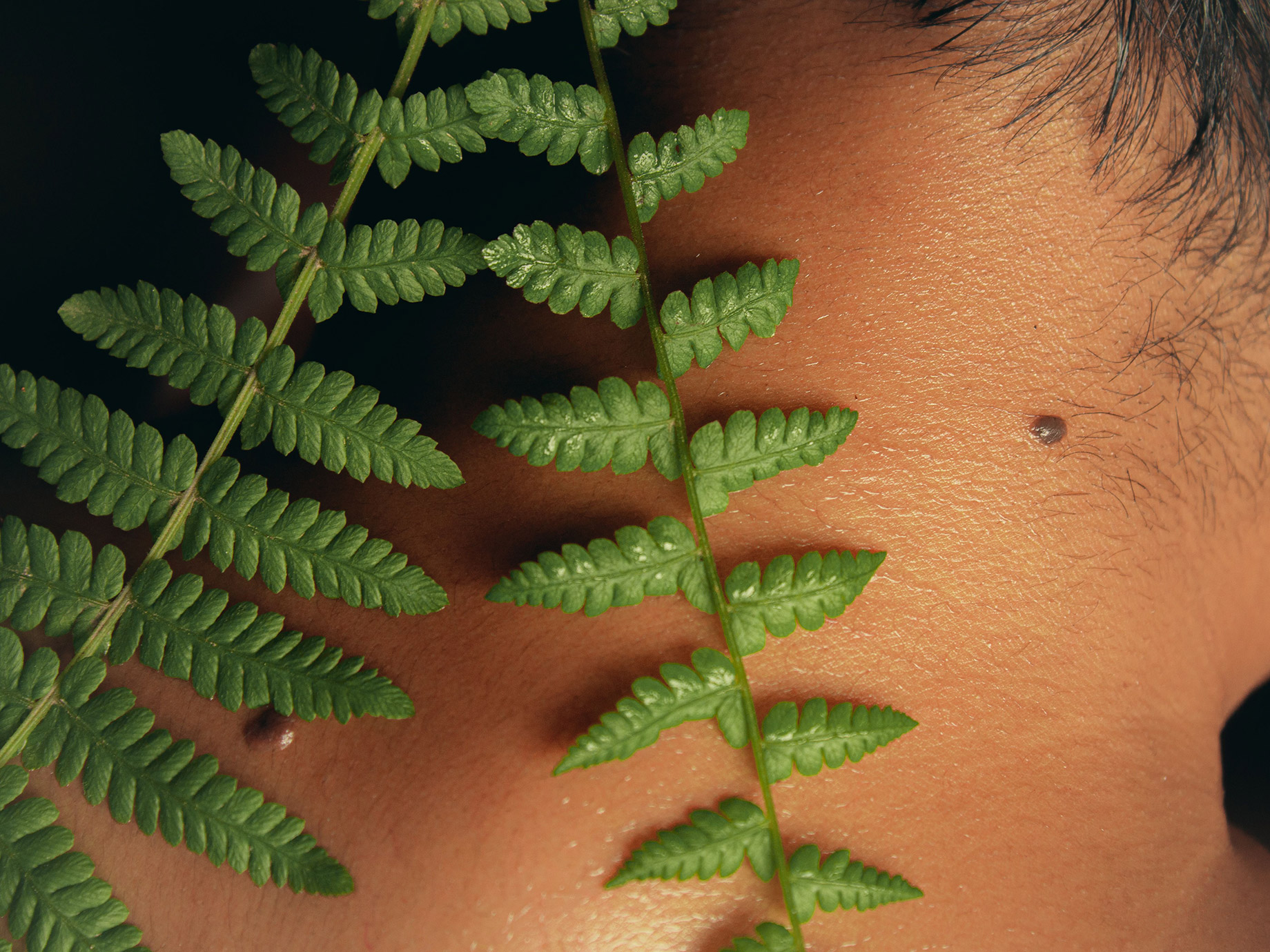 Close-up of a small raised skin tag on the side of a man’s neck, partially framed by green fern leaves.